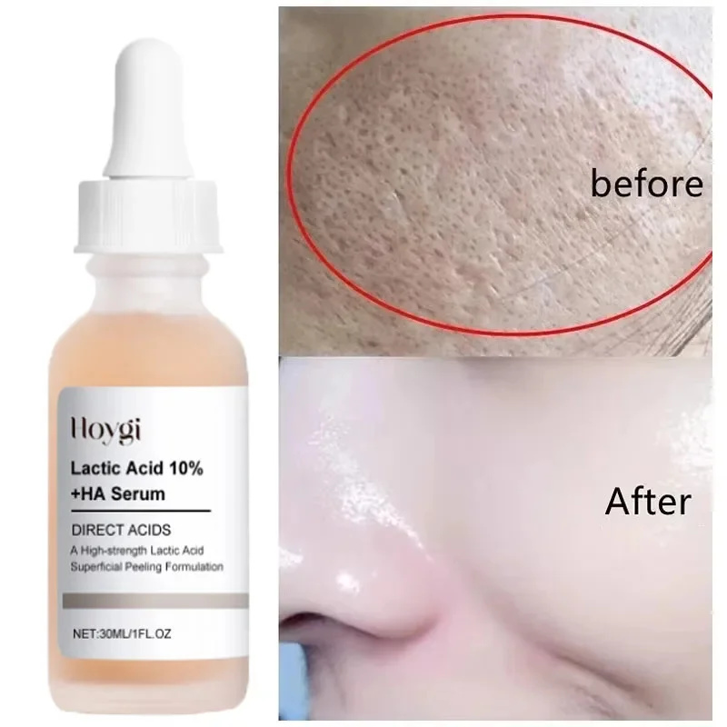 Lactic Acid Shrink Pores Serum - огляд і ціна Licorice Root Extract
