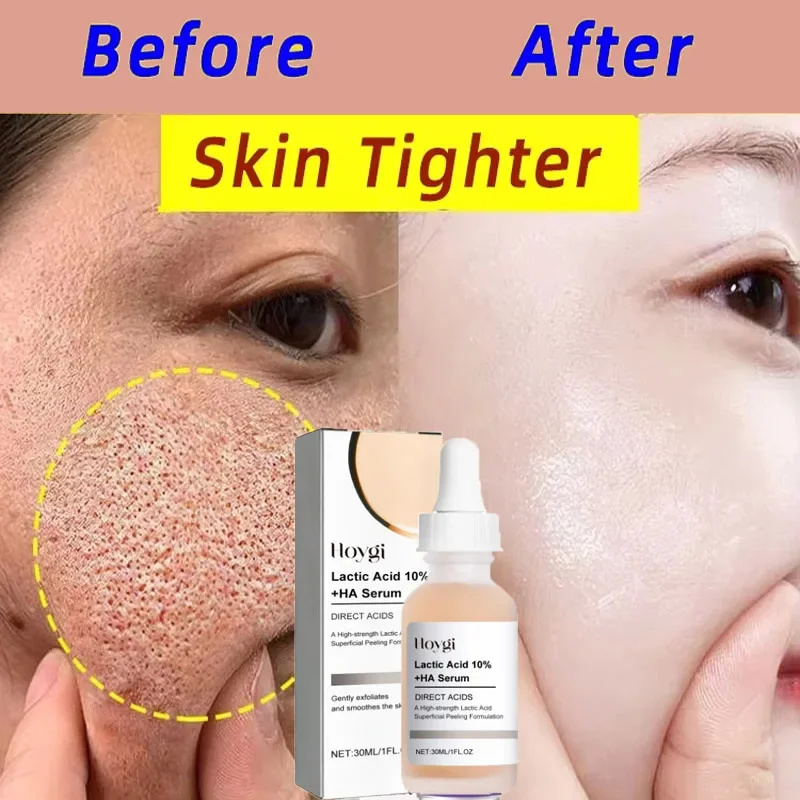 Lactic Acid Shrink Pores Serum - огляд і ціна Licorice Root Extract
