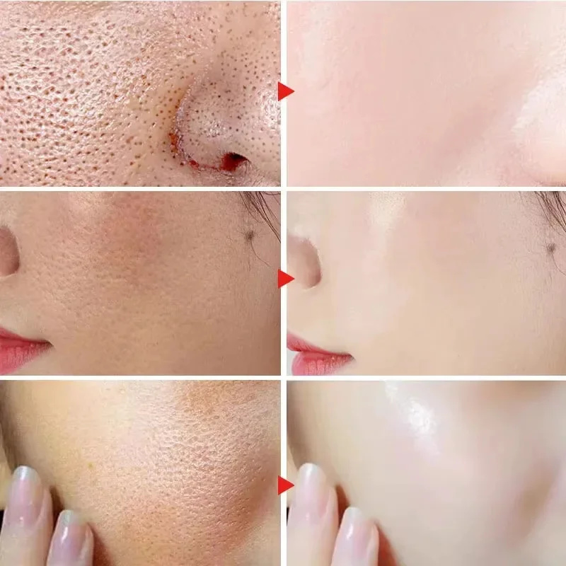 Lactic Acid Shrink Pores Serum - огляд і ціна Licorice Root Extract