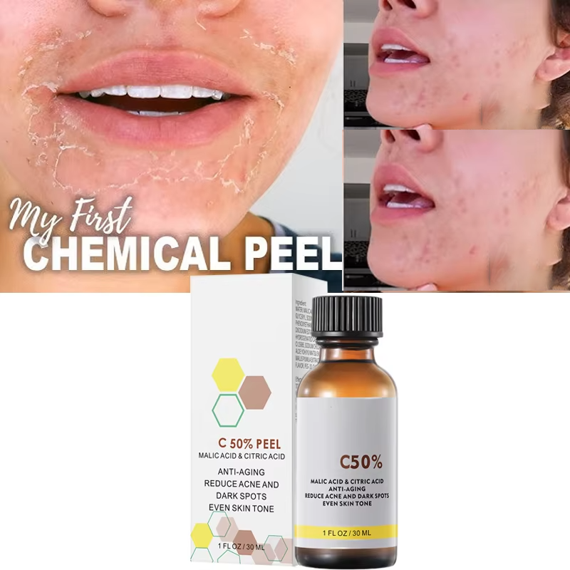 With Malic Acid And Citric Aci - огляд і ціна Licorice Root Extract