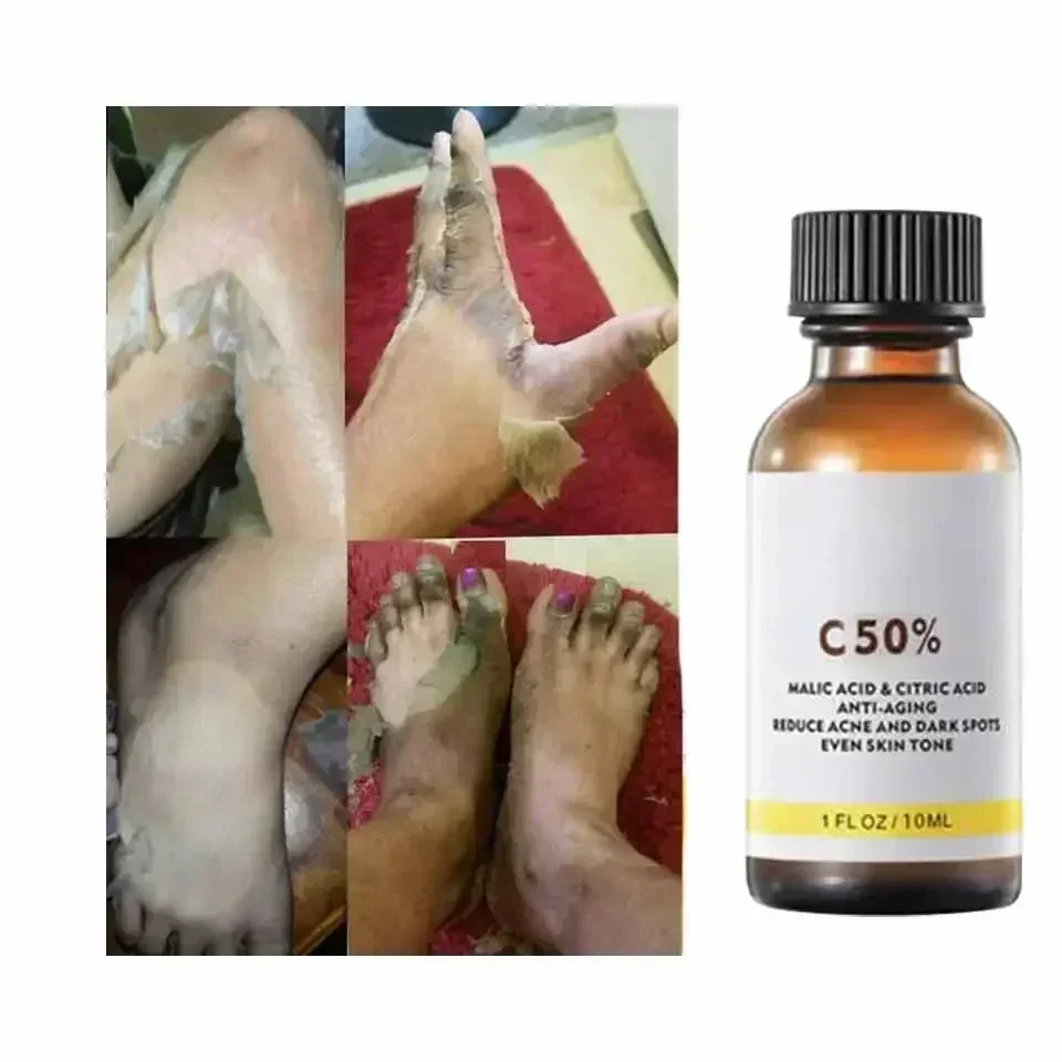With Malic Acid And Citric Aci - огляд і ціна Licorice Root Extract